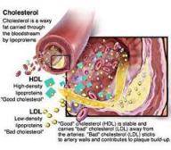 Pengobatan Tradisional Penyakit Kolesterol Alami
